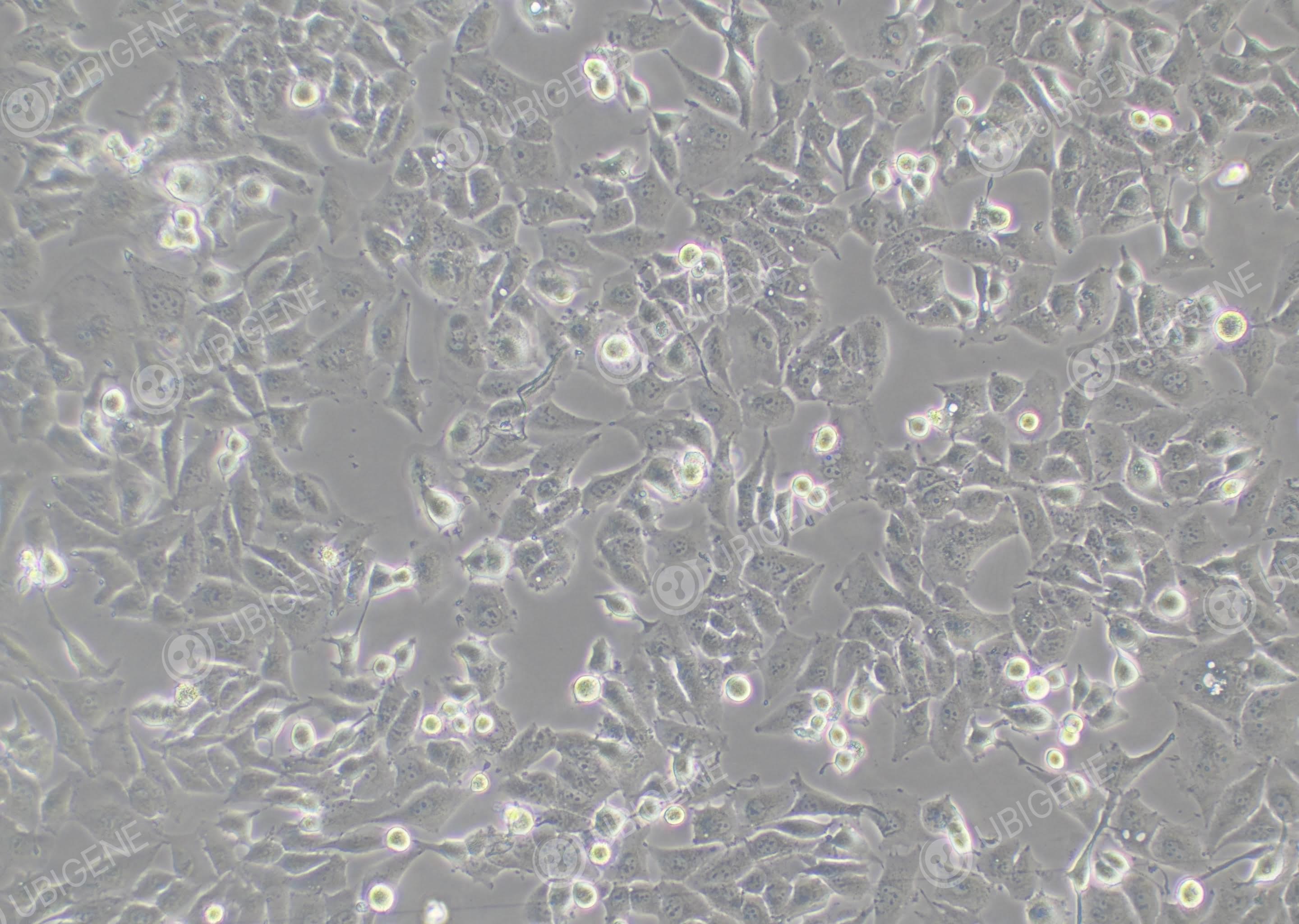 人肝癌细胞(MHCC97-H-Luc)-野生型1